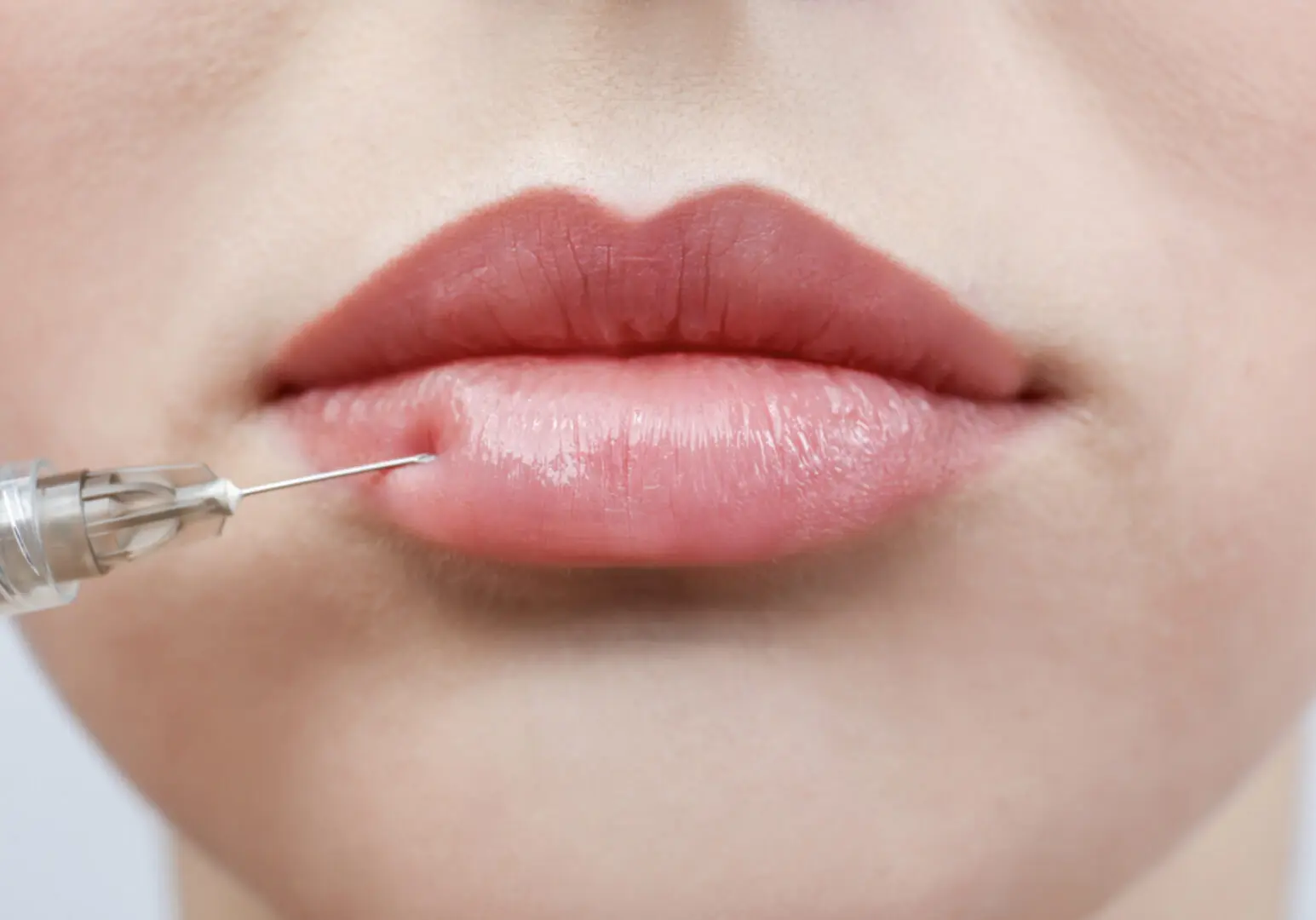 A woman is plucking her lips with a needle.