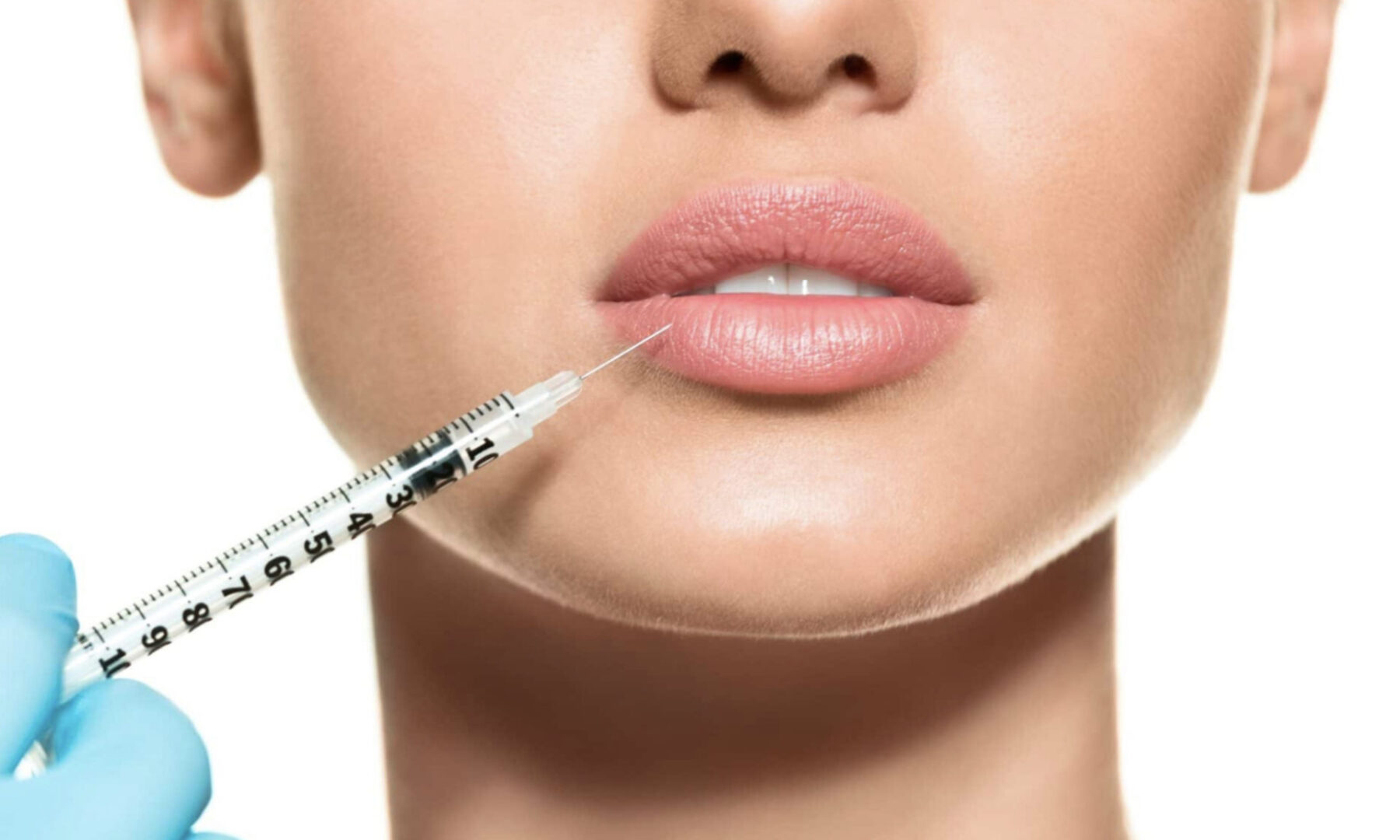 A woman is getting her lips filled with botox.